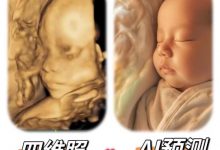 宝宝四维彩超AI生成预测长相图-淇淇有料